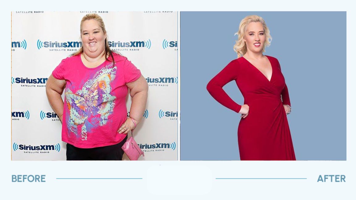 Mama June Shannon before and after